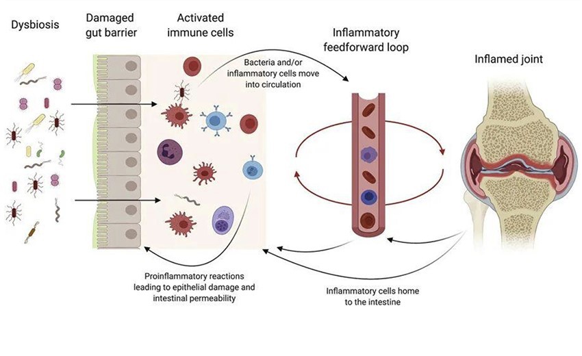 Anti Inflammatory Probiotics Anti Inflammatory Probiotics